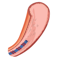 gl-cord-blood-02.png